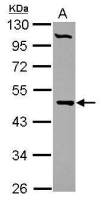 PCYT2 antibody