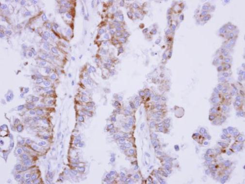 SHP1 antibody