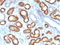 AMACR antibody [AMACR/3931R]