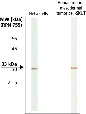 CDK4 antibody [DCS-31]