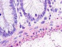 Chemokine Receptor D6 antibody