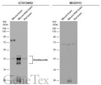 Doublecortin antibody