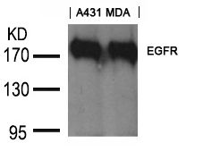EGFR antibody