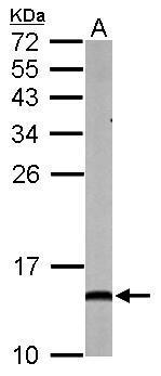 NDUFA5 antibody [N1C3]
