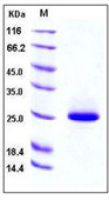 Mouse Lipocalin-2 protein, His tag (active)