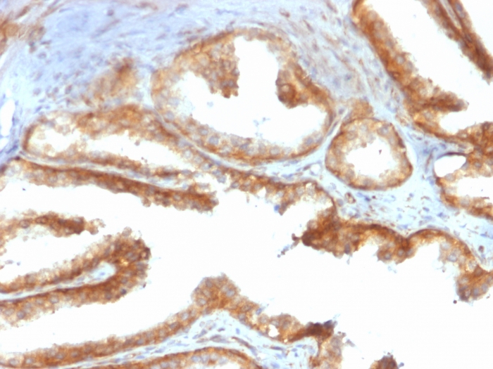 YB1 antibody [rYBX1/2430]
