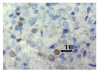 ID1 antibody [195-14]