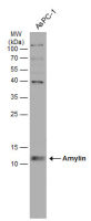Amylin antibody [N2C3]