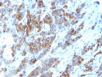 MUC1 antibody [SPM533]