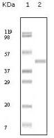 ABL2 antibody [1H1B11]