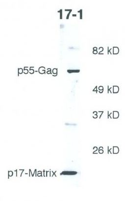 HIV1 P17 Gag antibody [17-1]
