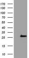 OTUB2 antibody [6C7]