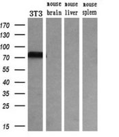 Transferrin antibody [5G2]