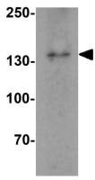 IL17 Receptor alpha antibody