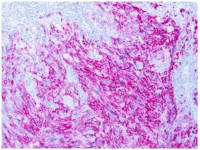 Melanoma antibody [PNL2]