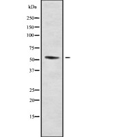 DMRTA1 antibody