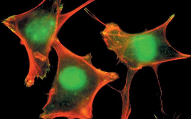 PLCG1 (phospho Tyr783) antibody