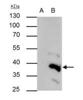 BRAF35 antibody [N2C3]