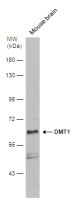 DMT1 antibody