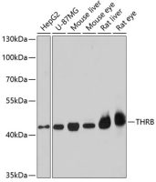 Thyroid Hormone Receptor beta antibody