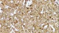 ZAP70 antibody [L453R]