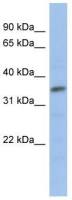 MYF5 antibody, N-term