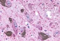 5-HT2B receptor antibody