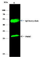 PMM2 antibody