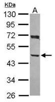 ACTR1A antibody