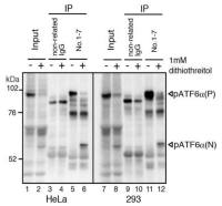 ATF6 antibody [1-7]