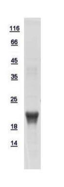 Human GADD45A protein, His tag