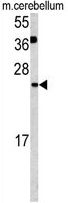 Glutaredoxin 2 antibody, C-term