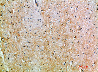TSPAN7 antibody