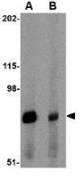 Integrin alpha 4 antibody