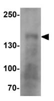 CRB1 antibody