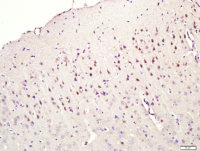 CNIH3 antibody