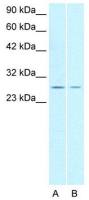 ZNF174 antibody, N-term