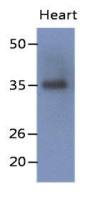 delta Sarcoglycan antibody [AT19G8]