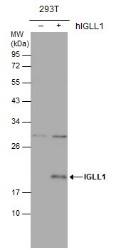 IGLL1 antibody