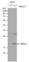 IGLL1 antibody