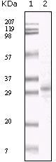 KSHV ORF26 antibody [2F6B8]