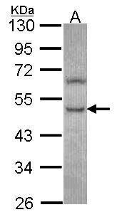 PHKG2 antibody [N2C3]