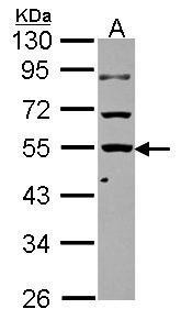 KLHDC4 antibody