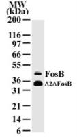 Fos B antibody [83B1138]