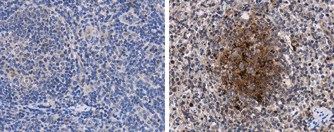 Porcine circovirus type 2 / PCV2 Capsid antibody产品图