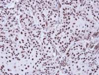 Apoptosis-enhancing nuclease antibody [C2C3], C-term