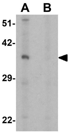 OLIG2 antibody
