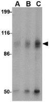 GluR6 antibody