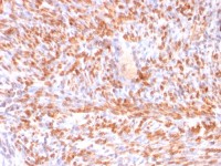 Calponin 1 antibody [rCNN1/832]