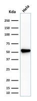 Fascin 1 antibody [SPM133]